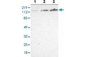 Western blot analysis of Lane 1: RT-4 cell lysate, Lane 2: U-251 MG sp cell lysate, Lane 3: A-431 cell lysate with WDHD1 polyclonal antibody at 1:250 - 1:500 dilution. (WDHD1 anticorps  (AA 231-345))