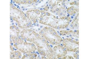 Immunohistochemistry of paraffin-embedded Mouse kidney using TARS Polyclonal Antibody at dilution of 1:100 (40x lens). (TARS anticorps)