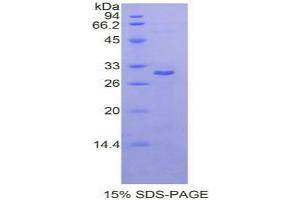 SDS-PAGE analysis of Rat MAPK8 Protein. (JNK Protéine)