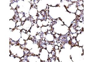 IHC analysis of RPL17 using anti-RPL17 antibody (ABIN7601639).