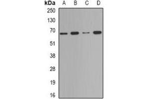 Western blot analysis of Deltex-2 expression in Jurkat (A), HepG2 (B), mouse testis (C), mouse spleen (D) whole cell lysates. (DTX2 anticorps)