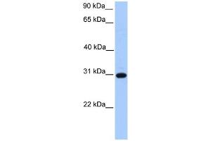 WB Suggested Anti-ETFB Antibody Titration: 0. (ETFB anticorps  (C-Term))