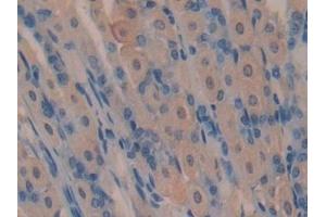 Detection of SOSTDC1 in Mouse Stomach Tissue using Polyclonal Antibody to Sclerostin Domain Containing Protein 1 (SOSTDC1)