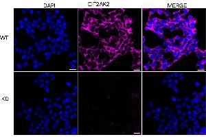 Immunocytochemical staining of HeLa cells using EIF2AK2 antibody (ABIN7798506), 1:1,000), Top panel: wild-type (WT), Bottom panal: EIF2AK2 shRNA knockdown (KD). (EIF2AK2 anticorps)