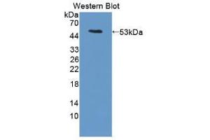 Western blot analysis of the recombinant protein. (LRG1 anticorps  (AA 136-342))