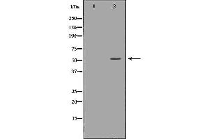 Western blot analysis of Hela whole cell lysates, using TRAF2  Antibody. (TRAF2 anticorps  (C-Term))