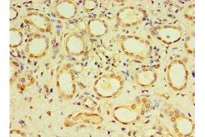 Immunohistochemistry of paraffin-embedded human kidney tissue using ABIN7149492 at dilution of 1:100 (DACT3 anticorps  (AA 1-160))