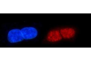 IF analysis of ERCC1 using anti-ERCC1 antibody (ABIN7599669).