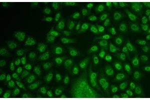 Immunofluorescence analysis of U2OS cells using TFPT Polyclonal Antibody (TFPT anticorps)