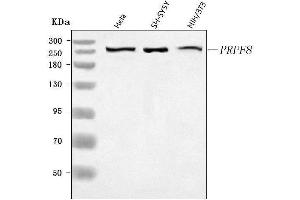 Western blot analysis of PRPF8 using anti-PRPF8 antibody (ABIN7601730).