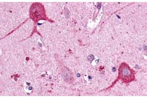 Immunohistochemical (Formalin/PFA-fixed paraffin-embedded sections) staining in human brain, neurons and glia with OPN3 polyclonal antibody . (OPN3 anticorps  (C-Term))