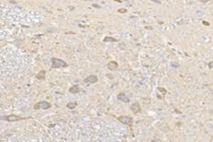 Immunohistochemistry analysis of paraffin-embedded rat substantia nigra using NCKAP1 (ABIN7074784) at dilution of 1: 8000