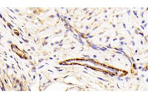 Detection of CALD in Rat Uterus Tissue using Polyclonal Antibody to Caldesmon (CALD)