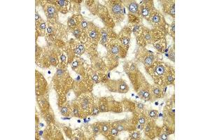Immunohistochemistry of paraffin-embedded human liver injury using MYO1C antibody.