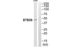 Western blot analysis of extracts from LOVO cells, using BTBD6 antiobdy.