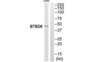 Western blot analysis of extracts from LOVO cells, using BTBD6 antiobdy. (BTBD6 anticorps)
