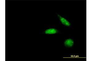 Immunofluorescence of purified MaxPab antibody to ZNF447 on HeLa cell. (ZSCAN18 anticorps  (AA 1-510))