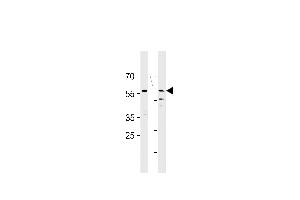 HCDC7L1 Antibody (M9) (ABIN1882165 and ABIN2841618) western blot analysis in HT29,MCF-7 cell line lysates (35 μg/lane). (CDC7 anticorps  (N-Term))