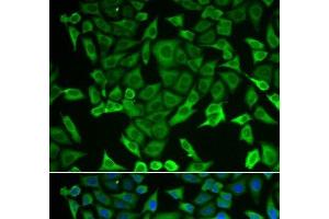 Immunofluorescence analysis of MCF-7 cells using RARS Polyclonal Antibody (RARS anticorps)
