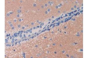 DAB staining on IHC-P; Samples: Mouse Cerebrum Tissue