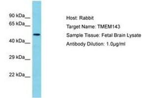 Image no. 1 for anti-Transmembrane Protein 143 (TMEM143) (AA 39-88) antibody (ABIN6750625) (TMEM143 anticorps  (AA 39-88))