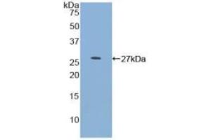 Western blot analysis of recombinant Human MYOC. (MYOC anticorps  (AA 224-471))
