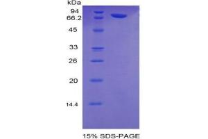 SDS-PAGE analysis of Human PLAA Protein.