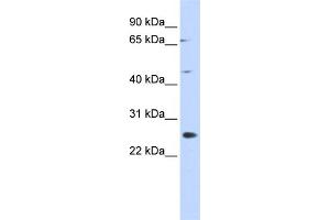 WB Suggested Anti-SPATA22 Antibody Titration: 0. (SPATA22 anticorps  (N-Term))