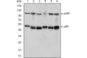 Western blot analysis using NFKB1 mouse mAb against K562 (1), Jurkat (2), A431 (3), Hela (4), THP-1 (5) and MCF-7 (6) cell lysate.