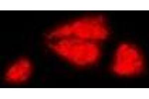 Immunofluorescent analysis of DAX1 staining in MCF7 cells. (NR0B1 anticorps)