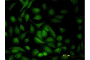 Immunofluorescence of monoclonal antibody to PRKAB1 on HeLa cell.