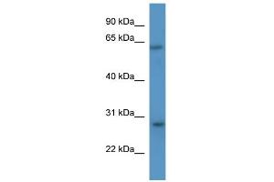 WB Suggested Anti-Cish Antibody Titration: 0. (CISH anticorps  (N-Term))