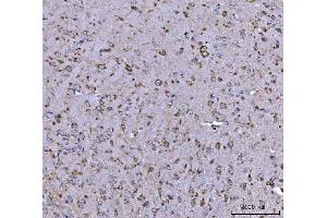 IHC analysis of BBS9 using anti-BBS9 antibody (ABIN7601518). (BBS9 anticorps  (AA 37-793))