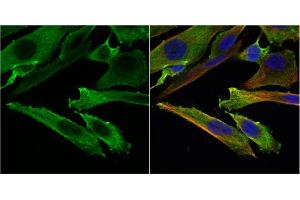 ICC/IF Image Stathmin 1 antibody detects Stathmin 1 protein at cytoplasm by immunofluorescent analysis. (Stathmin 1 anticorps  (C-Term))