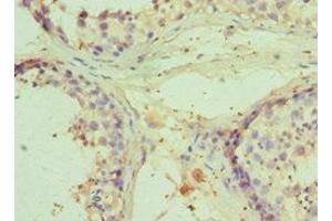 Immunohistochemistry of paraffin-embedded human testis tissue using ABIN7151208 at dilution of 1:100 (RNF8 anticorps  (AA 1-260))