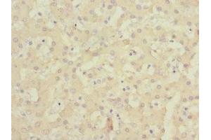 Immunohistochemistry of paraffin-embedded human liver tissue using ABIN7147123 at dilution of 1:100 (CD166 anticorps  (AA 28-180))