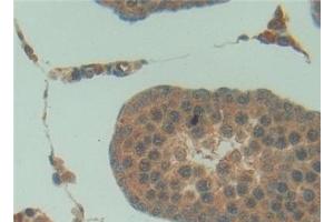 Detection of SFTPA1 in Rat Testis Tissue using Polyclonal Antibody to Pulmonary Surfactant Associated Protein A1 (SFTPA1)