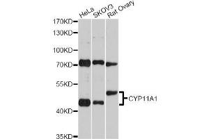 Western blot analysis of extracts of various cell lines, using CYP11A1 Antibody (ABIN5970856) at 1/2000 dilution. (CYP11A1 anticorps)