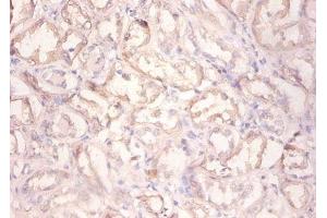 Immunohistochemistry of paraffin-embedded human kidney tissue using ABIN7154210 at dilution of 1:100 (PYGL anticorps  (AA 2-846))