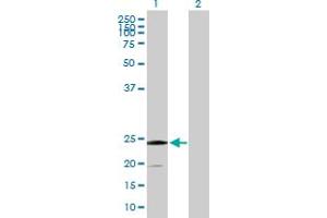 Western Blot analysis of SSR2 expression in transfected 293T cell line by SSR2 MaxPab polyclonal antibody.