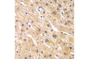 Immunohistochemistry of paraffin-embedded human liver injury using RPS7 antibody at dilution of 1:100 (x40 lens). (RPS7 anticorps)
