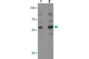Western blot analysis of PLAGL2 in rat brain tissue with PLAGL2 polyclonal antibody  at (1) 1 and (2) 2 ug/mL. (PLAGL2 anticorps  (N-Term))