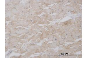 Immunoperoxidase of monoclonal antibody to SGCB on formalin-fixed paraffin-embedded human heart. (SGCB anticorps  (AA 1-318))
