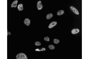 Immunofluorescent staining of HeLa (ATCC CCL-2) cells. (PSME3 anticorps  (AA 45-147))