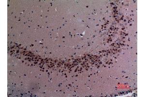 Immunohistochemistry (IHC) analysis of paraffin-embedded Mouse Brain, antibody was diluted at 1:100.