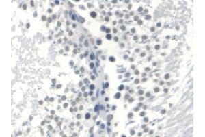 Detection of AR in Rat Testis Tissue using Monoclonal Antibody to Androgen Receptor (AR)