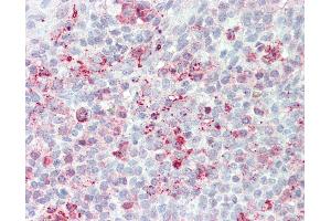 Anti-STEAP2 antibody IHC of human tonsil.