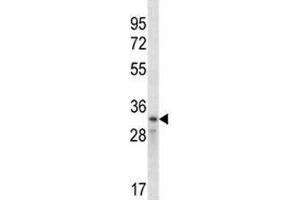 Cyclin D2 antibody western blot analysis in CEM lysate