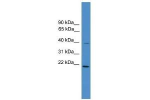 DNAJB4 antibody used at 0. (DNAJB4 anticorps  (Middle Region))