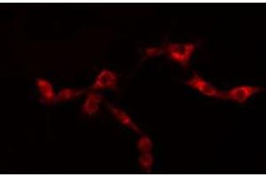 ABIN6276441 staining  SKOV3 cells by IF/ICC. (GRP94 anticorps  (C-Term))